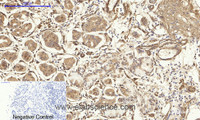 Immunohistochemistry of paraffin-embedded Human stomach tissue using CAV1 Polyclonal Antibody at dilution of 1:200.