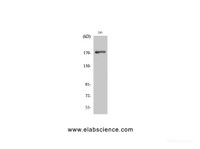 Western Blot analysis of 293 cells using EGFR Polyclonal Antibody at dilution of 1:1000.