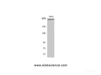 Western Blot analysis of HuvEc cells using FLNA Polyclonal Antibody at dilution of 1:2000.