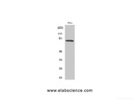 Western Blot analysis of Hela cells using FoxO1 Polyclonal Antibody at dilution of 1:500.