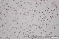 Immunohistochemistry of paraffin-embedded Rat brain using FOXO3 Polyclonal Antibody at dilution of 1:50