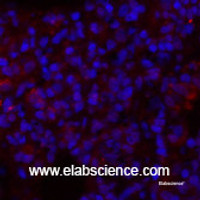 Immunofluorescence analysis of Rat lung tissue using GLUT-1 Polyclonal Antibody at dilution of 1:200.