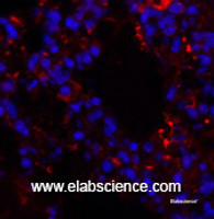 Immunofluorescence analysis of Mouse lung tissue using HIF1 alpha Polyclonal Antibody at dilution of 1:200.