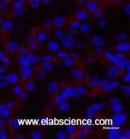 Immunofluorescence analysis of Rat kidney tissue using JAK3 Polyclonal Antibody at dilution of 1:200.