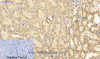 Immunohistochemistry of paraffin-embedded Mouse kidney tissue using NFκB-p65 Polyclonal Antibody at dilution of 1:200.