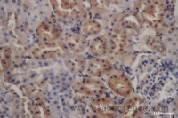 Immunohistochemistry of paraffin-embedded Rat kidney using PDGFRB Polyclonal Antibody at dilution of 1:50