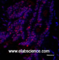 Immunofluorescence analysis of Rat lung tissue using SIRT1 Polyclonal Antibody at dilution of 1:200.