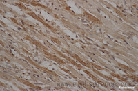 Immunohistochemistry of paraffin-embedded Mouse heart using Stat3 antibody at dilution of 1:50