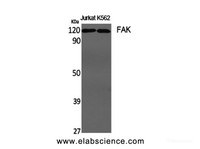 Western Blot analysis of Jurkat, K562 cells using FAK Polyclonal Antibody at dilution of 1:1000.