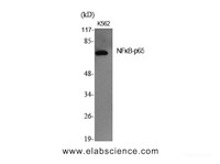 Western Blot analysis of K562 cells using NFκB-p65 Polyclonal Antibody at dilution of 1:2000.