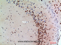 Immunohistochemistry of paraffin-embedded Mouse brain tissue using SNCA Polyclonal Antibody at dilution of 1:200.