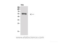 Western Blot analysis of Hela cells using Vimentin Polyclonal Antibody at dilution of 1:500.