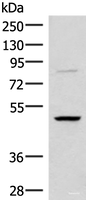 Western blot analysis of Human bladder transitional cell carcinoma grade 2-3 tissue lysate using RRP8 Polyclonal Antibody at dilution of 1:800