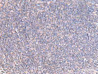 Immunohistochemistry of paraffin-embedded Human tonsil tissue using GRIA2 Polyclonal Antibody at dilution of 1:40 (×200)