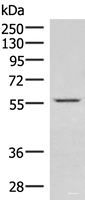 Western blot analysis of Jurkat cell lysate using IPPK Polyclonal Antibody at dilution of 1:550