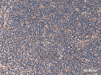 Immunohistochemistry of paraffin-embedded Human tonsil tissue using ITPR2 Polyclonal Antibody at dilution of 1:60 (×200)