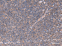 Immunohistochemistry of paraffin-embedded Human tonsil tissue using JPH2 Polyclonal Antibody at dilution of 1:40 (×200)