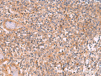 Immunohistochemistry of paraffin-embedded Human tonsil tissue using CREBBP Polyclonal Antibody at dilution of 1:35 (×200)