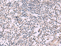 Immunohistochemistry of paraffin-embedded Human tonsil tissue using KCNIP1 Polyclonal Antibody at dilution of 1:40 (×200)