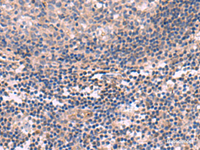 Immunohistochemistry of paraffin-embedded Human tonsil tissue using KCNT1 Polyclonal Antibody at dilution of 1:30 (×200)