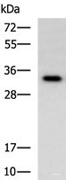 Western blot analysis of Human fetal liver tissue lysate using IL1B Polyclonal Antibody at dilution of 1:650