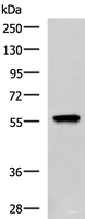 Western blot analysis of A549 cell lysate using TERF1 Polyclonal Antibody at dilution of 1:1000