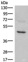 Western blot analysis of SKOV3 cell lysate using NCR1 Polyclonal Antibody at dilution of 1:350