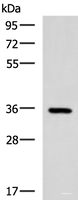 Western blot analysis of Mouse brain tissue lysate using B3GAT1 Polyclonal Antibody at dilution of 1:650