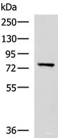 Western blot analysis of Mouse brain tissue lysate using CAPN5 Polyclonal Antibody at dilution of 1:550