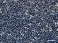 Immunohistochemistry of paraffin-embedded Human tonsil tissue using CUL5 Polyclonal Antibody at dilution of 1:55 (×200)