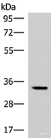Western blot analysis of Mouse adrenal gland tissue lysate using FOSL2 Polyclonal Antibody at dilution of 1:550