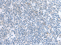 Immunohistochemistry of paraffin-embedded Human tonsil tissue using IL1B Polyclonal Antibody at dilution of 1:55 (×200)