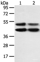 Western blot analysis of K562 and hela cell using MAPK8 Polyclonal Antibody at dilution of 1:600