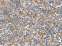 Immunohistochemistry of paraffin-embedded Human tonsil tissue using TGFBI Polyclonal Antibody at dilution of 1:75 (×200)
