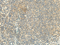 Immunohistochemistry of paraffin-embedded Human tonsil tissue using ALPK1 Polyclonal Antibody at dilution of 1:50 (×200)