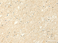 Immunohistochemistry of paraffin-embedded Human brain tissue using ALPK1 Polyclonal Antibody at dilution of 1:50 (×200)