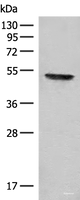 Western blot analysis of Mouse thymus tissue lysate using FGL2 Polyclonal Antibody at dilution of 1:300