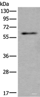 Western blot analysis of Mouse testis tissue lysate using SCP2 Polyclonal Antibody at dilution of 1:350