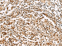 Immunohistochemistry of paraffin-embedded Human tonsil tissue using XRCC4 Polyclonal Antibody at dilution of 1:60 (×200)