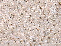Immunohistochemistry of paraffin-embedded Human brain tissue using HIF1A Polyclonal Antibody at dilution of 1:45 (×200)