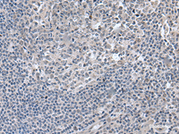 Immunohistochemistry of paraffin-embedded Human tonsil tissue using EDARADD Polyclonal Antibody at dilution of 1:50 (×200)