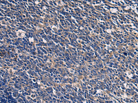 Immunohistochemistry of paraffin-embedded Human tonsil tissue using ABHD14B Polyclonal Antibody at dilution of 1:60 (×200)