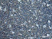 Immunohistochemistry of paraffin-embedded Human tonsil tissue using LYPLA1 Polyclonal Antibody at dilution of 1:80 (×200)