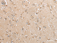 Immunohistochemistry of paraffin-embedded Human brain tissue using GCLC Polyclonal Antibody at dilution of 1:35 (×200)