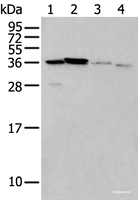 Western blot analysis of 293T cell Mouse brain tissue and Human kidney tissue lysates using LASP1 Polyclonal Antibody at dilution of 1:350