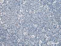 Immunohistochemistry of paraffin-embedded Human tonsil tissue using LASP1 Polyclonal Antibody at dilution of 1:35 (×200)