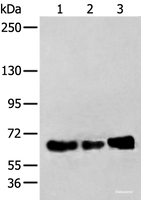 Western blot analysis of TM4 K562 and A431 cell lysates using ZBTB5 Polyclonal Antibody at dilution of 1:250