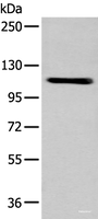 Western blot analysis of A549 cell using ZNF281 Polyclonal Antibody at dilution of 1:600