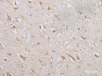 Immunohistochemistry of paraffin-embedded Human brain tissue using ZNF281 Polyclonal Antibody at dilution of 1:70 (×200)