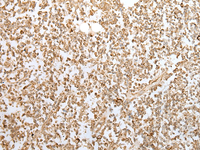 Immunohistochemistry of paraffin-embedded Human tonsil tissue using ZKSCAN1 Polyclonal Antibody at dilution of 1:30 (×200)